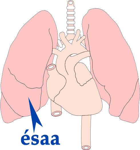 Ésaa